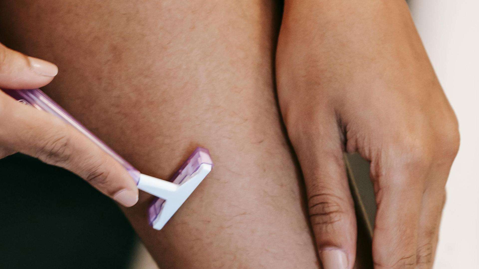 Ingrown hairs